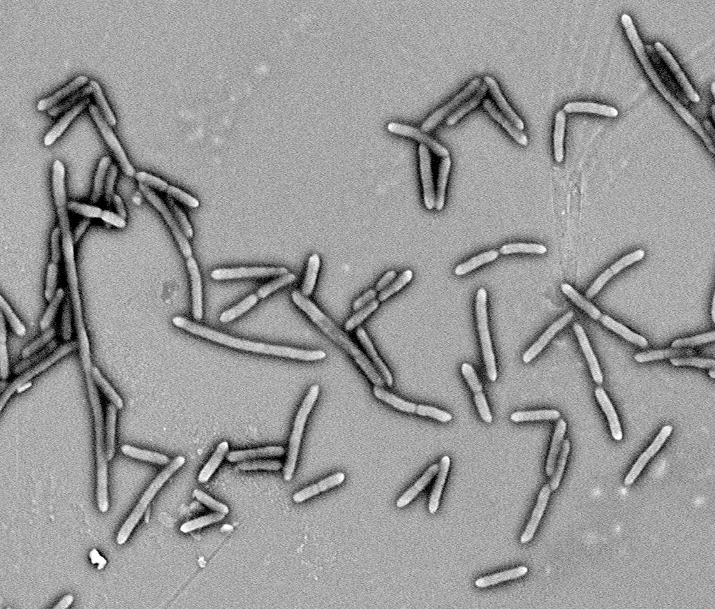 This image shows gut bacteria in culture. Photo: Tao Liu and Xiaoyan Pang/Shanghai Jiao Tong University