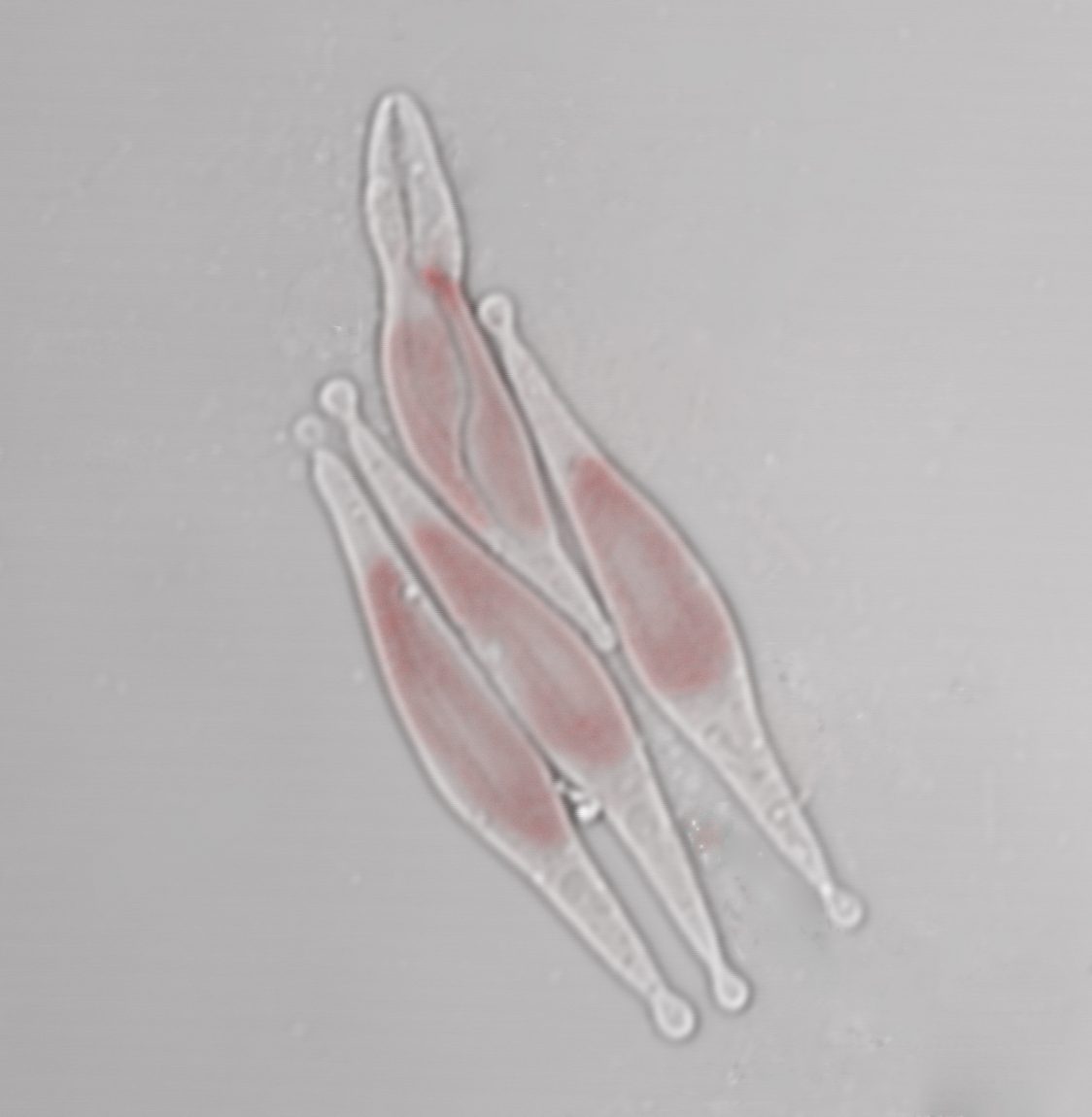 These are Phaeodactylum tricornutum diatoms. Image: Ananya Agarwal/Rutgers Biophysics Molecular Ecology Laboratory